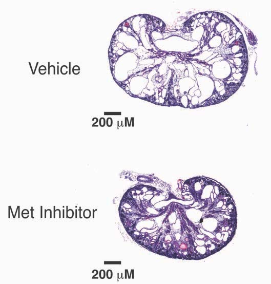 Polycystic kidney disease modeled in mice