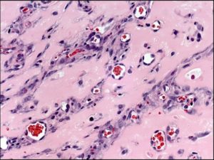 engineered blood vessels in mice