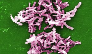 c difficile