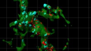 a microglial cell in the lateral geniculate nucleus