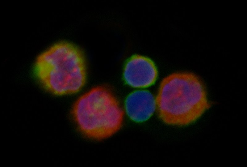 A mixed population of T cells (CD4+ cells) from a mouse