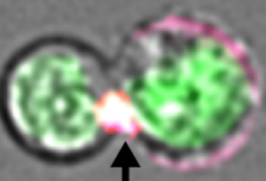 T cell attacking immature red blood cell