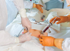 bone marrow transplant operation