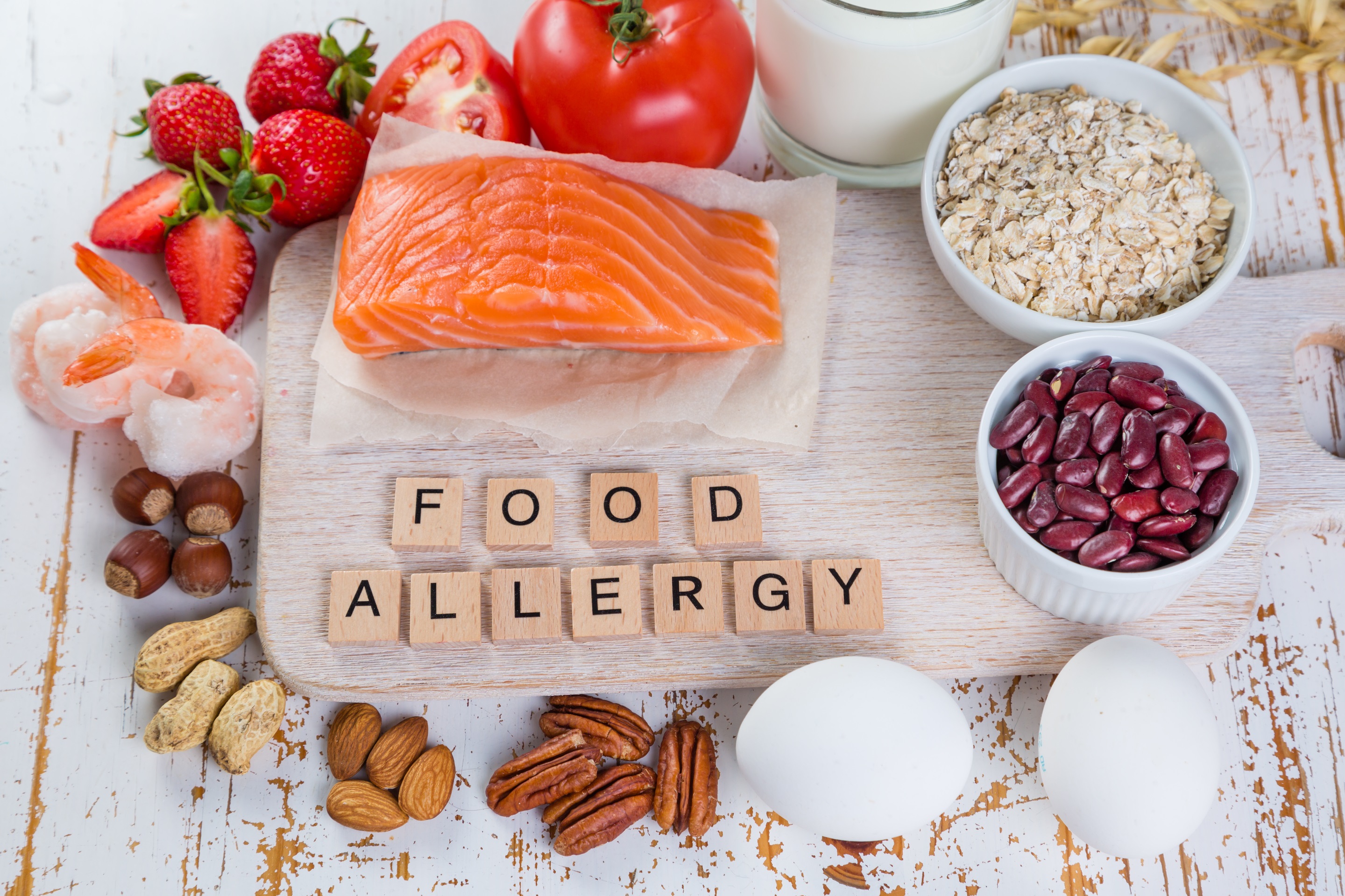 your-guide-to-the-common-food-allergens-your-responsibility-s