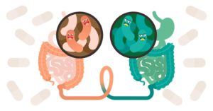 fecal microbiota transplant FMT concept