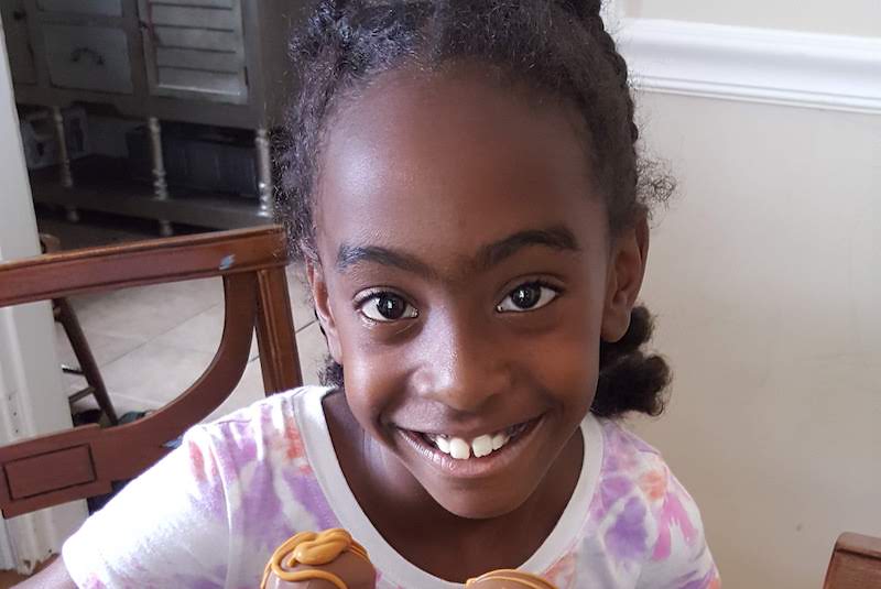 Jasmine, who had a Pott's puffy tumor, smiles for the camera