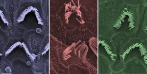CRISPR hearing loss