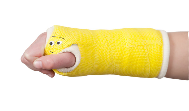 childs arm in a cast