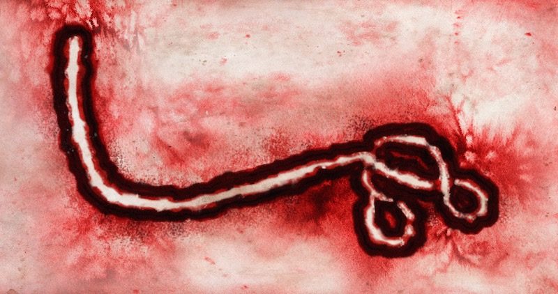 Ebola under the microscope