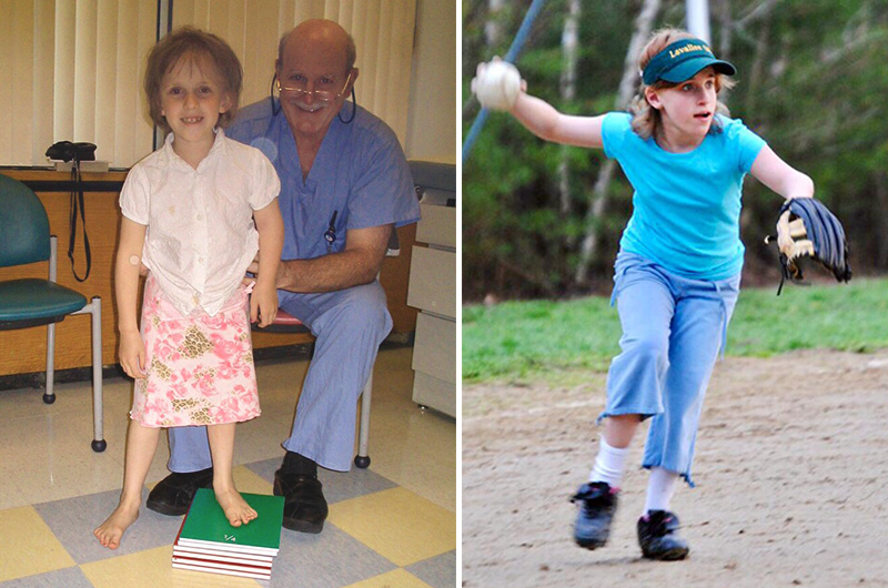 Lauren, who was born with a leg-length discrepancy, at age 7 with her shorter leg on a stack of books and as a pre-teen playing softball.