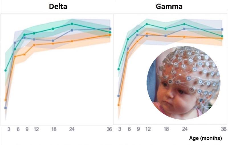 early EEG is predictive of autism