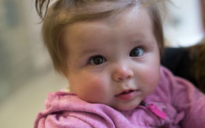 Charlotte, who got a second opinion before she was born, smiles