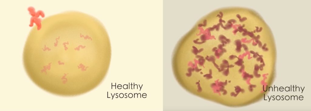 lysosomes in Batten disease