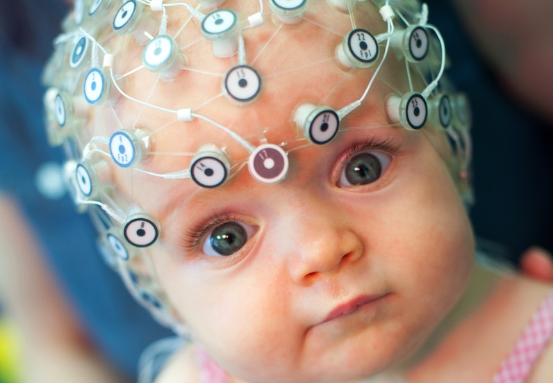 EEG studies of autism and developmental synaptopathies