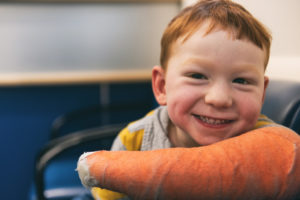 simon shows off the orange cast on his arm