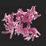 Could nitazoxanide help curb tuberculosis?