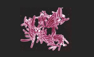 Could nitazoxanide help curb tuberculosis?