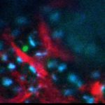 blood stem cells in bone marrow