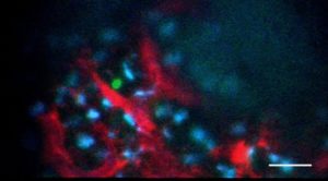 blood stem cells in bone marrow