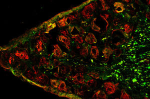 immunofluorescence image of inflamed mouse cell in endometriosis model