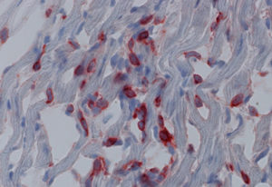 cells from mutant TsAd mice displaying organ failure