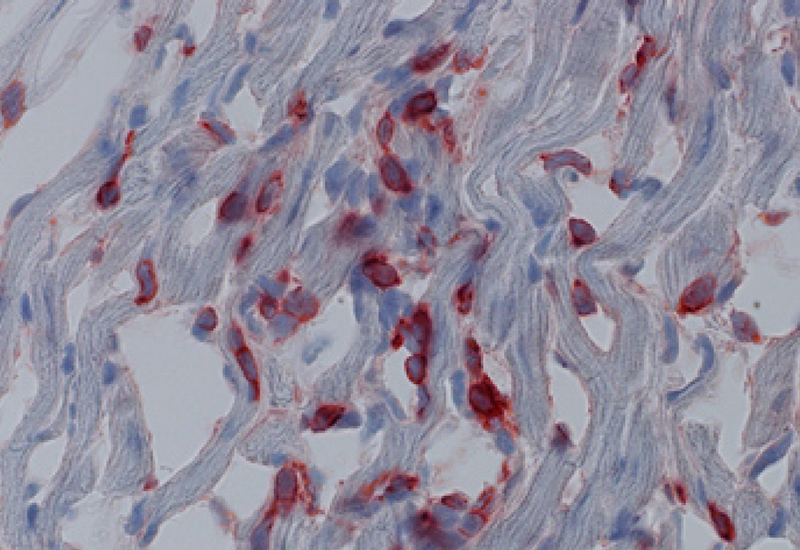 cells from mutant TsAd mice displaying organ failure