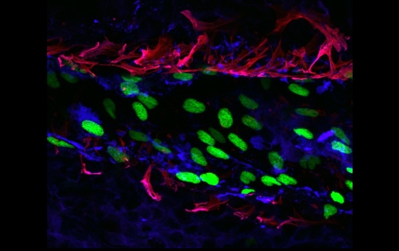 A blood vessel in a tumor, with nuclei lit up green to indicate high S1P signaling