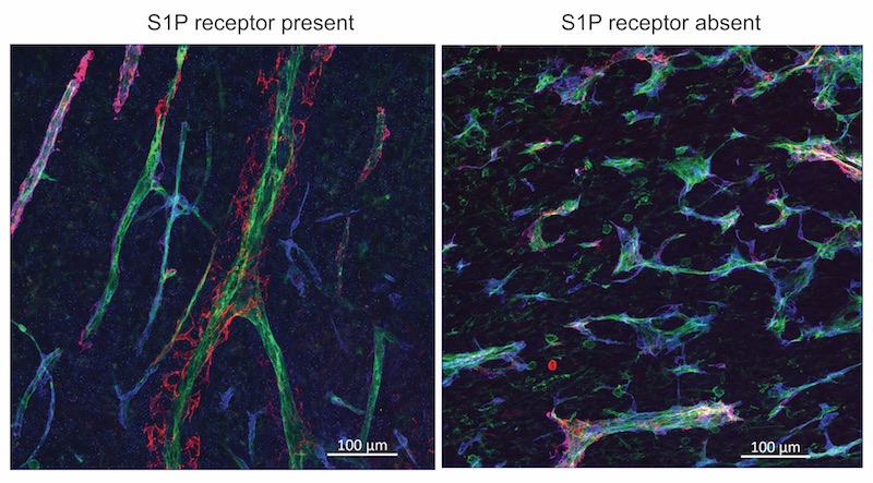 Tumor vessels in mice with and without the S1P receptor