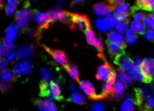 bioengineered blood vessel secreting factor VIII for hemophilia