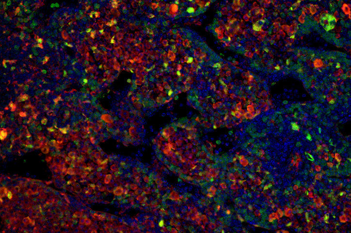 chimeric neuroblastoma cell fluorescent