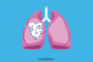 lung with shield and COVID-19