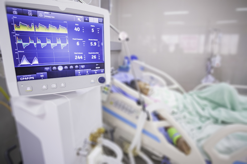 an intensive care unit with ventilator monitor and intubated patient