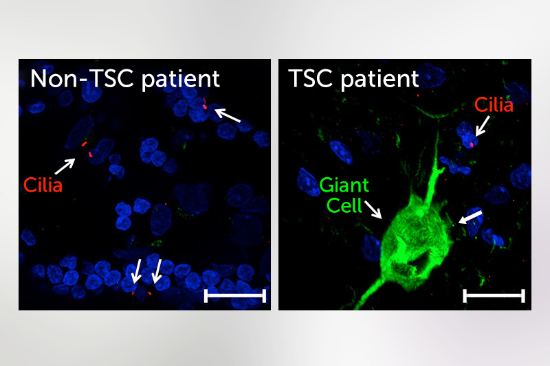 neuron images from TSC and non-TSC cells show differences in cilia
 