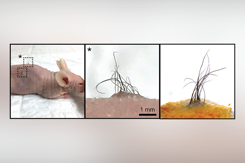 photos of mouse with transplanted growing human hair