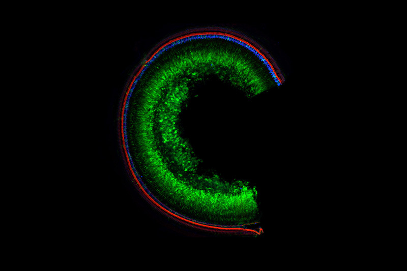 microscope image of mouse cochlea with repaired Tmc1 gene 