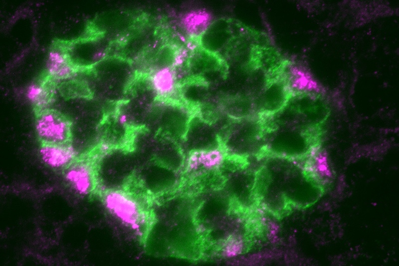 kidney glomerulus with WT-1, a master genetic regulator of podocytes