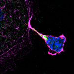 image of natural killer cell sprouting nanotube to a placenta cell and transferring granulysin