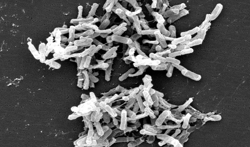 c. difficile at high magnification