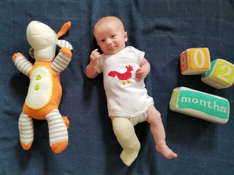 Finn, who was born with clubfoot, next to a doll that he is slightly longer than and blocks that say 2 months. He is wearing a cast on his right leg.  