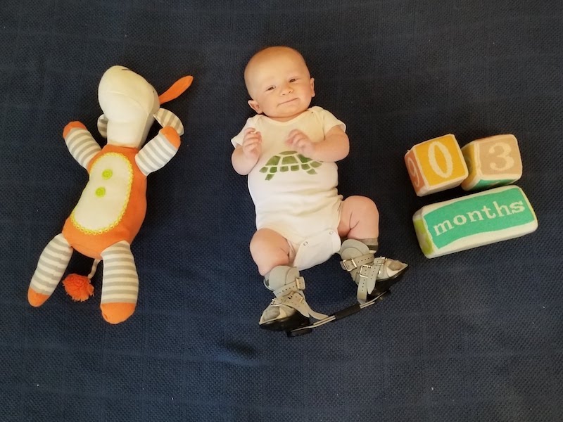Finn, who was born with clubfoot, next to a doll and blocks that say 3 months. He is wearing a clubfoot brace that holds his feet in an outward-pointing position. 
