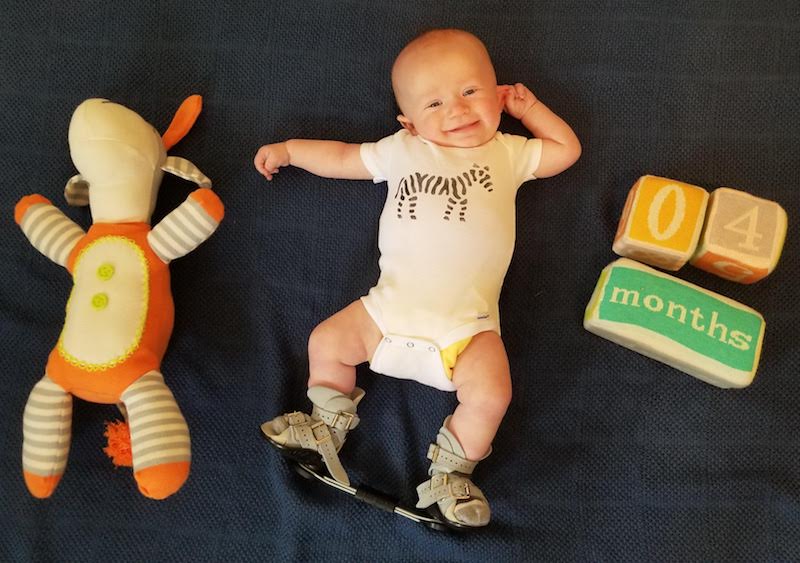 Finn, who was born with clubfoot, next to a doll that he has grown visibly larger than and blocks that say 4 months. He is wearing a brace on his feet. 