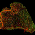 choroid plexus with immune cells