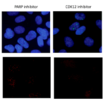 how PARP and CDK12 inhibitors combine to deal a lethal blow to Ewing sarcoma