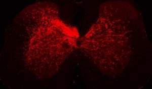 spinal cord axon sprouting