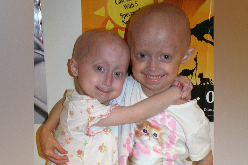 Photo of Meghan Waldron and Megan Nighbor, the first two children in the first lonafarnib clinical trial at Boston Children's in 2007.
