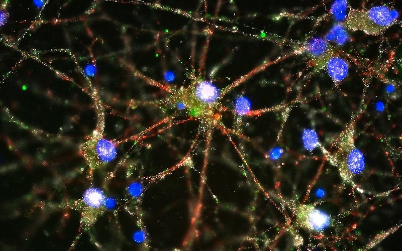 C4 complement (in green) located at the synapses of human neurons.