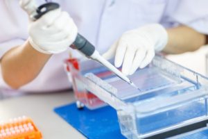 electrophoresis