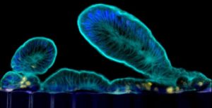intestine chip