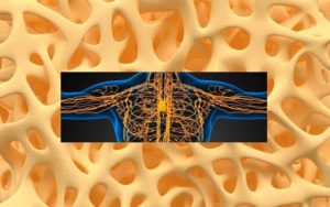 Gorham-Stout syndrome