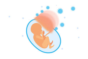 COVID-19 And The Placenta: How Are Newborns Protected? - Boston ...